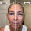 (Leve 2 e ganhe 40% de DESCONTO) Escova De Drenagem Linfática Facial - Rosto Desinchado, Luminoso e Relaxado em Minutos