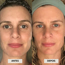 (Leve 2 e ganhe 40% de DESCONTO) Escova De Drenagem Linfática Facial - Rosto Desinchado, Luminoso e Relaxado em Minutos